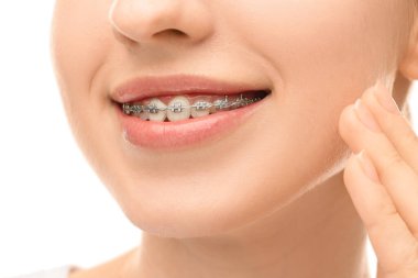 Beyaz arka planda diş telleri olan gülümseyen kadın, yakın plan.