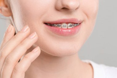 Gri arka planda diş telleri olan gülümseyen kadın, yakın plan.