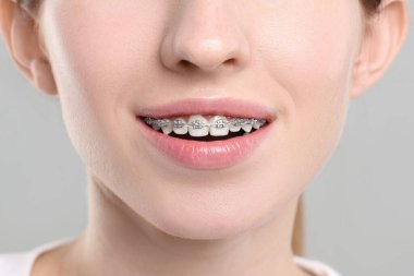 Gri arka planda diş telleri olan gülümseyen kadın, yakın plan.