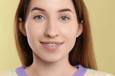 Açık yeşil arka planda diş telleri olan gülümseyen kadın portresi, yakın plan.