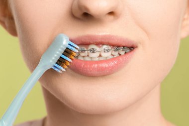 Dişlerinde diş teli olan gülümseyen kadın açık yeşil arka planda dişleri temizliyor, yakın plan.