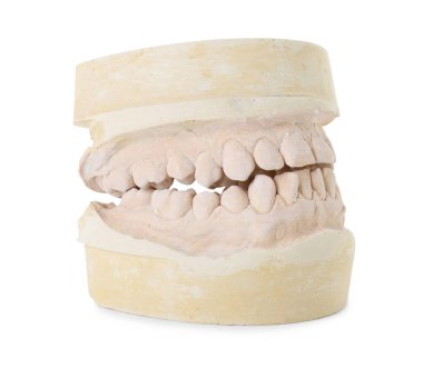 Ağzı beyaza ayrılmış bir diş modeli. Diş kalıpları
