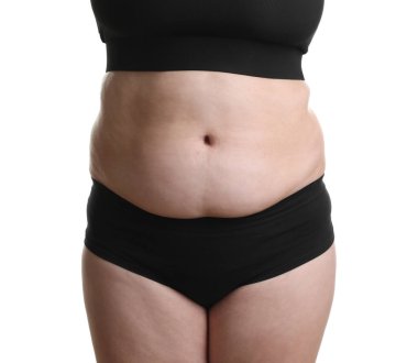 Beyaz arka planda aşırı göbek yağlı bir kadın, yakın plan. Aşırı kilolu