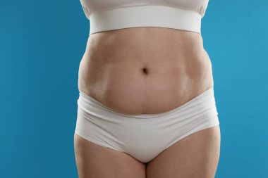 Açık mavi arka planda göbeği aşırı yağlı bir kadın, yakın plan. Aşırı kilolu