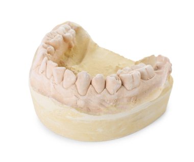 Çenesi beyaza ayrılmış bir diş modeli. Diş kalıpları