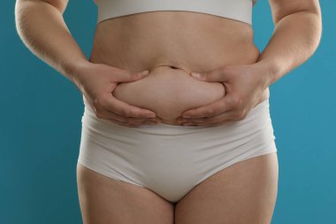 Açık mavi arka planda göbek yağına dokunan kadın, yakın plan. Aşırı kilolu