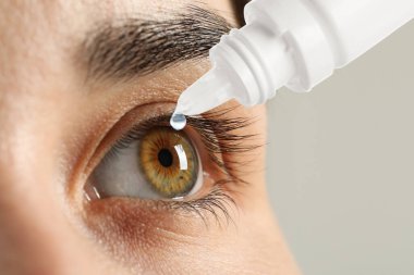 Işık arkaplanına göz damlası uygulayan kadın, yakın plan