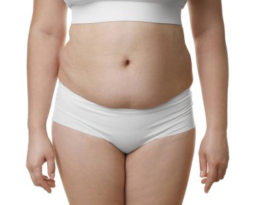 Beyaz arka planda aşırı göbek yağlı bir kadın, yakın plan. Aşırı kilolu