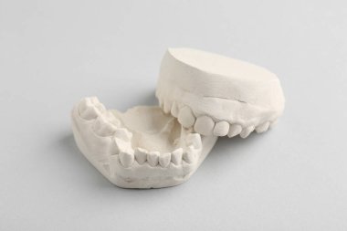 Açık gri arka planda diş etleri olan bir dişçi modeli. Diş kalıpları