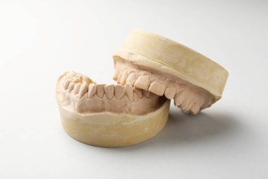 Açık gri arka planda diş etleri olan bir dişçi modeli. Diş kalıpları