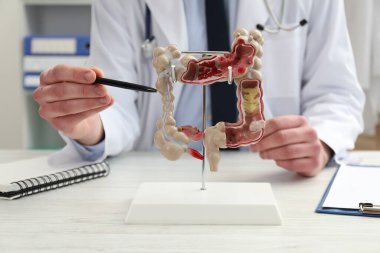 Doktor, klinikteki beyaz ahşap masada kalın bağırsak modeli gösteriyor.