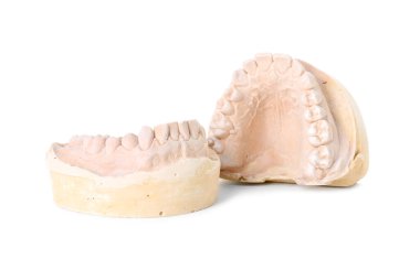 Ağzı beyaza ayrılmış bir diş modeli. Diş kalıpları