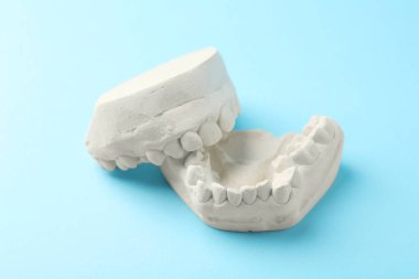 Açık mavi arka planda diş etleri olan bir dişçi modeli. Diş kalıpları