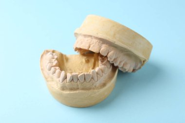 Açık mavi arka planda diş etleri olan bir dişçi modeli. Diş kalıpları