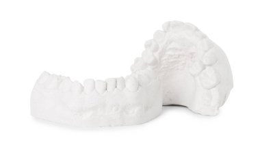 Beyaz dişeti olan diş eti modeli. Diş kalıpları