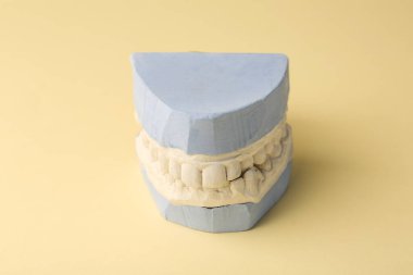 Sarı arka planda diş etleri olan bir diş modeli. Diş kalıpları