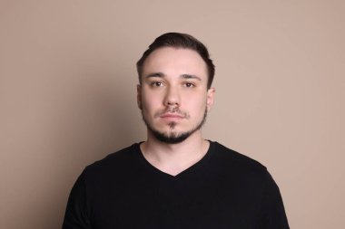 Kellik konsepti. Bej arka planda saçları dökülen üzgün bir adam.