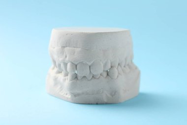 Açık mavi arka planda diş etleri olan bir dişçi modeli. Diş kalıpları
