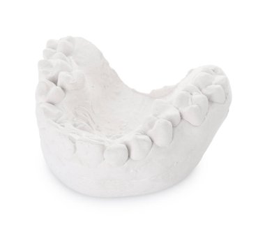 Beyaz sakızlı diş modeli. Diş kalıpları