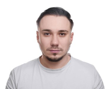 Kellik konsepti. Beyaz arka planda saçı dökülen üzgün bir adam.