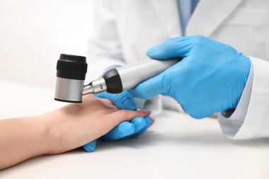 Dermatoskoplu bir dermatolog klinikteki beyaz masada hastayı muayene ediyor.