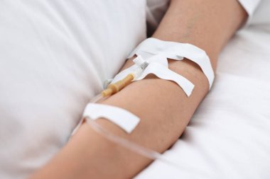 Hastane yatağında damardan damlayan kadın, yakın plan.