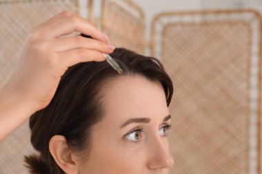 Saç dökülme problemi. Kadın kapalı alanda saç çizgisine serum uyguluyor, yakın plan.