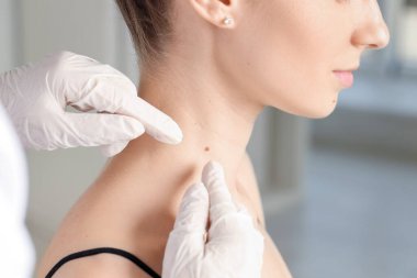 Klinikte kadının benini inceleyen doktor, yakın plan.