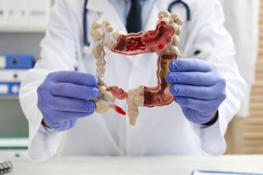 Klinikteki beyaz masada kalın bağırsak modeli olan doktor, seçici odaklanma