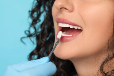 Doktor açık mavi arka planda genç kadının diş rengini kontrol ediyor. Yakın plan. Diş kaplamaları