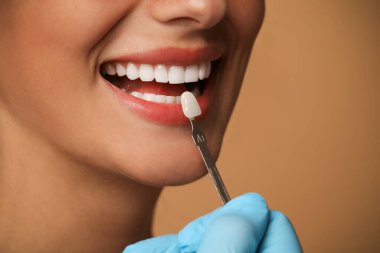Doktor bej arka planda genç kadının diş rengini kontrol ediyor, yakın plan. Diş kaplamaları