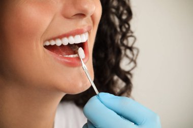 Doktor açık gri arka planda genç kadının diş rengini kontrol ediyor, yakın plan. Diş kaplamaları