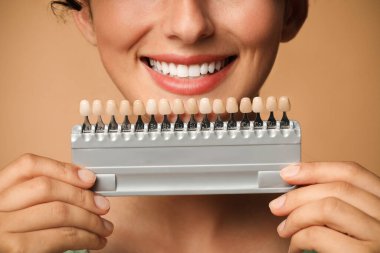 Bej arka planda diş rengi örnekleri olan gülümseyen kadın, yakın plan. Diş kaplamaları