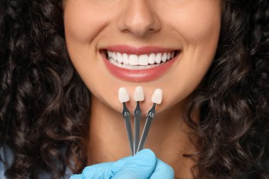 Doktor genç kadının diş rengini kontrol ediyor, yakın plan. Diş kaplamaları