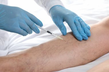 Varisli damar tedavisi. Doktor içeride hastaya iğne yapıyor, yakın plan.