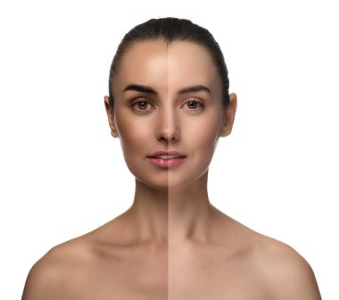 Beyaz arka planda solaryum bronzlaşmasından önce ve sonra güzel genç bir kadının fotoğraflarıyla kolaj.