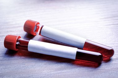 Tahta masada boş etiketli test tüplerindeki kan, yakın plan. Laboratuvar analizi