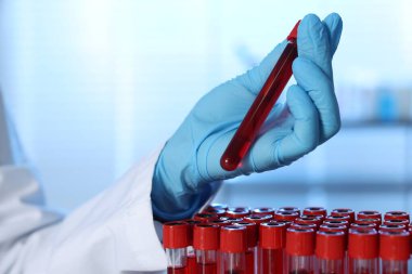 Laboratuvar testi. Doktor elinde kan örneğiyle test tüpü tutuyor, yakın plan.