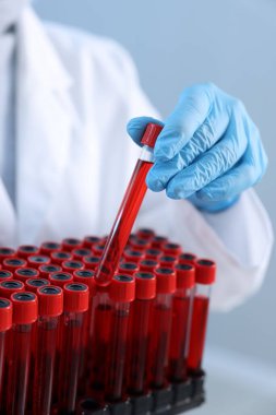Laboratuvar testi. Kapalı kapılar ardında kan örnekleri olan bir doktor.