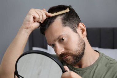 Adam aynanın içinde saçını tarıyor. Alopecia sorunu