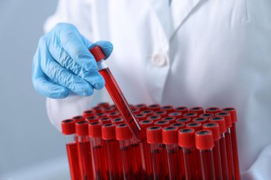 Laboratuvar testi. Kapalı kapılar ardında kan örnekleri olan bir doktor.