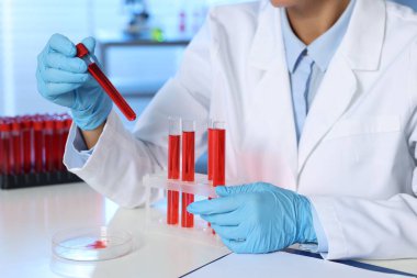 Laboratuvar testi. Doktor kan örnekleri kapalı bir masada, yakın plan.