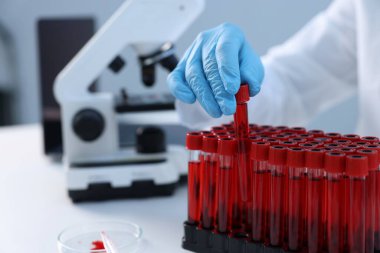 Laboratuvar testi. Doktor kan örneğiyle birlikte test tüpünü kapalı bir masada, yakın plan çekimde alıyor.