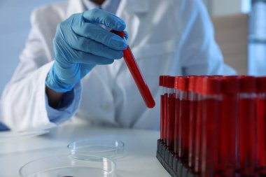 Laboratuvar testi. Doktor, kapalı bir masada raftan kan örneği alarak test tüpü alıyor.
