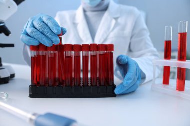 Laboratuvar testi. Doktor kan örneğiyle birlikte test tüpünü kapalı bir masada, yakın plan çekimde alıyor.