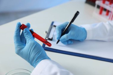 Laboratuvar testi. Kan örneği alan doktor kapalı bir masada not alıyor, yakın plan.
