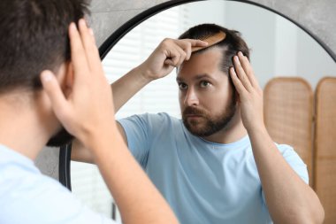 Adam aynanın içinde saçını tarıyor. Alopecia sorunu