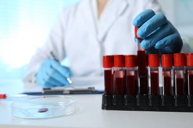 Laboratuvar testi. Doktor kan örneğiyle test tüpü alıyor. Masada çalışırken, yakın plan.