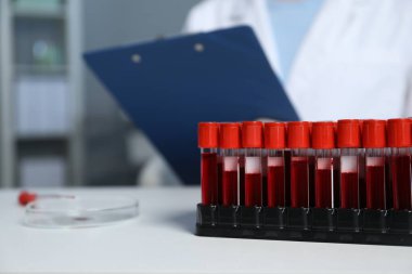 Laboratuvar testi. İçeride çalışan doktor, kan örneklerine odaklan.