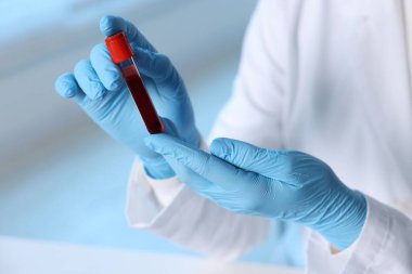 Laboratuvar testi. Doktor elinde kan örneğiyle test tüpü tutuyor, yakın plan.